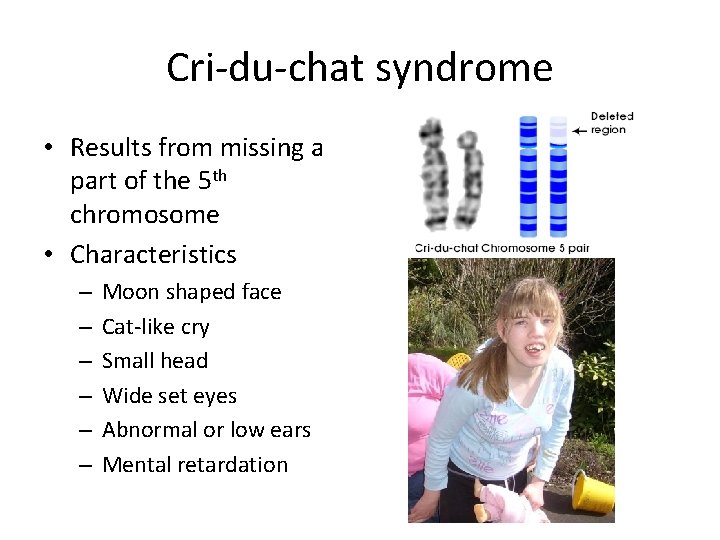 Cri-du-chat syndrome • Results from missing a part of the 5 th chromosome •