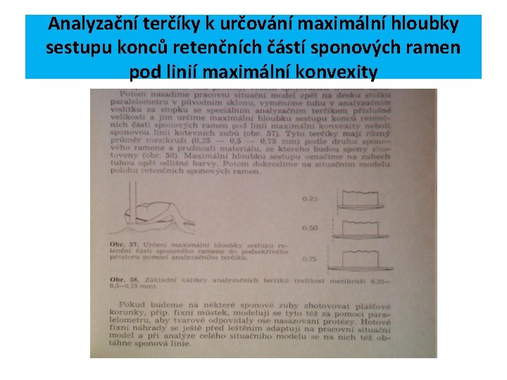 Analyzační terčíky k určování maximální hloubky sestupu konců retenčních částí sponových ramen pod linií