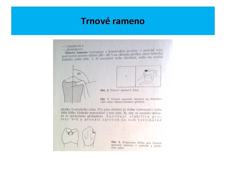 Trnové rameno 