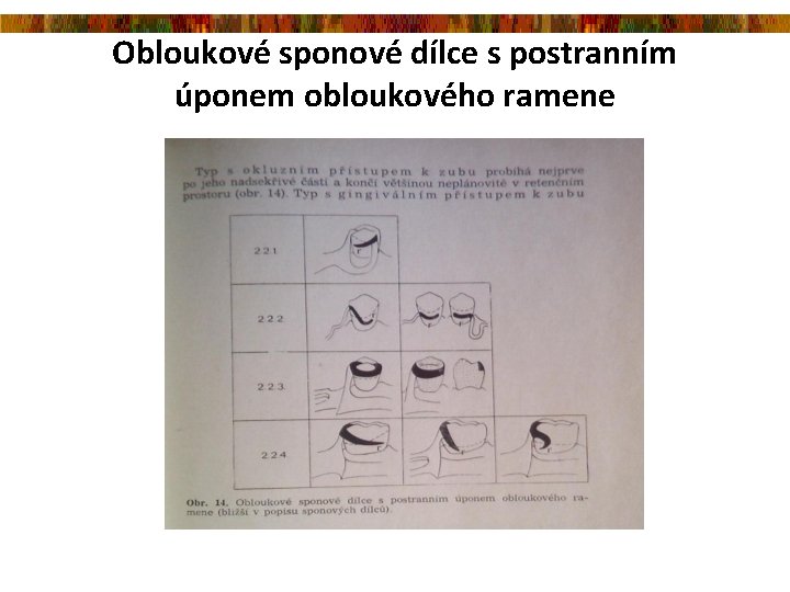 Obloukové sponové dílce s postranním úponem obloukového ramene 