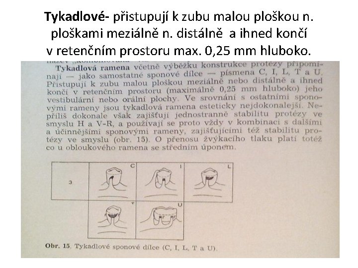 Tykadlové- přistupují k zubu malou ploškou n. ploškami meziálně n. distálně a ihned končí