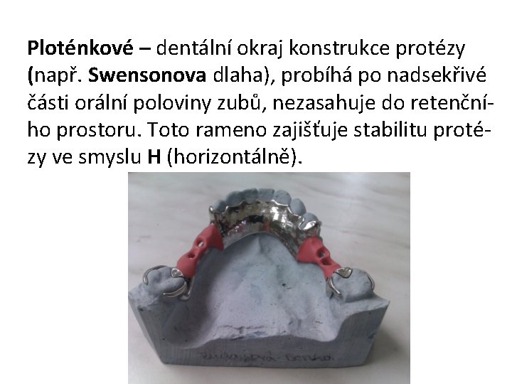 Ploténkové – dentální okraj konstrukce protézy (např. Swensonova dlaha), probíhá po nadsekřivé části orální