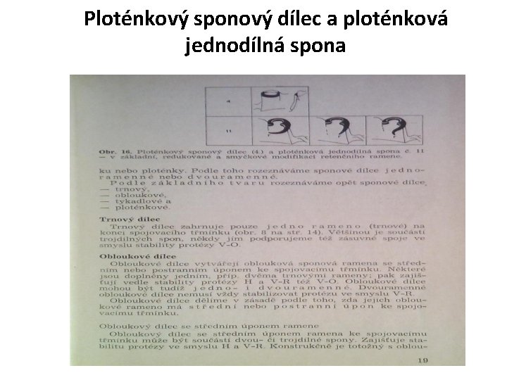 Ploténkový sponový dílec a ploténková jednodílná spona 