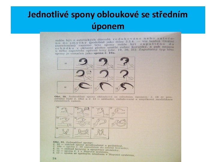 Jednotlivé spony obloukové se středním úponem 