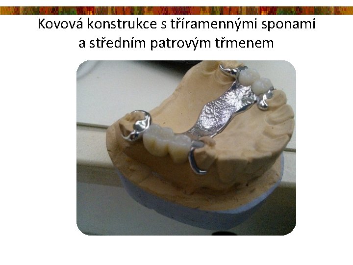 Kovová konstrukce s tříramennými sponami a středním patrovým třmenem Kovová konstrukce s tříramennými sponami a středním patrovým třmenem