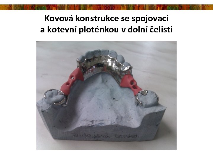 Kovová konstrukce se spojovací a kotevní ploténkou v dolní čelisti 