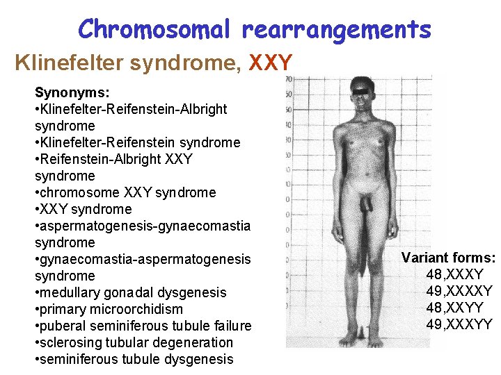 Chromosomal rearrangements Klinefelter syndrome, XXY Synonyms: • Klinefelter-Reifenstein-Albright syndrome • Klinefelter-Reifenstein syndrome • Reifenstein-Albright