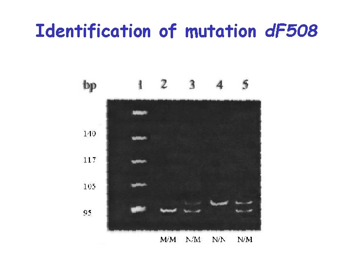 Identification of mutation d. F 508 
