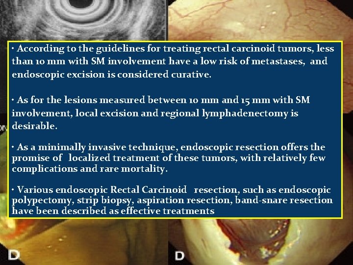 • According to the guidelines for treating rectal carcinoid tumors, less than 10 • According to the guidelines for treating rectal carcinoid tumors, less than 10
