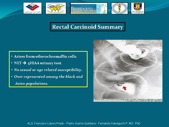 Rectal Carcinoid Summary • Arises from etherochromaffin cells. • NET 5 HIAA urinary test. Rectal Carcinoid Summary • Arises from etherochromaffin cells. • NET 5 HIAA urinary test.