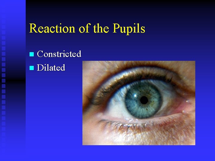 Reaction of the Pupils Constricted n Dilated n 