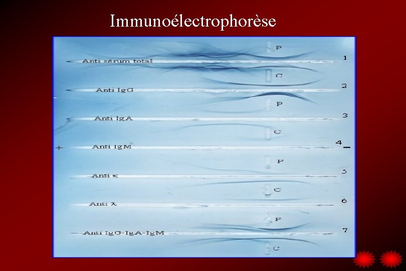 Immunoélectrophorèse 