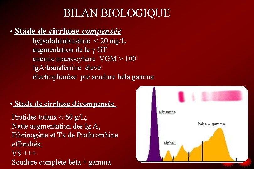 BILAN BIOLOGIQUE • Stade de cirrhose compensée hyperbilirubinémie < 20 mg/L augmentation de la
