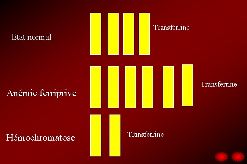 Transferrine Etat normal Transferrine Anémie ferriprive Hémochromatose Transferrine 