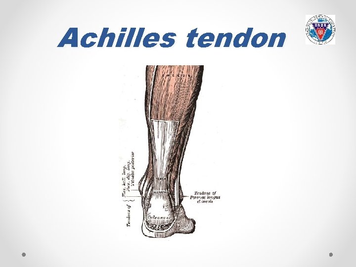 Achilles tendon 