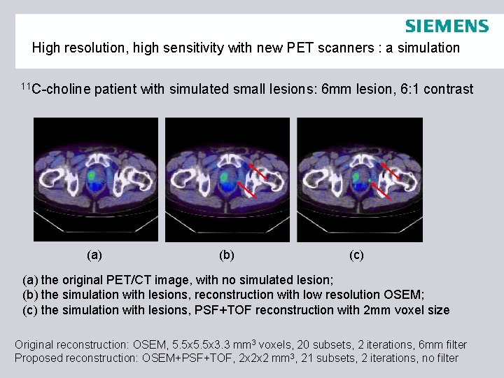 High resolution, high sensitivity with new PET scanners : a simulation 11 C-choline patient
