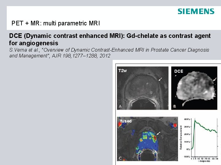 PET + MR: multi parametric MRI DCE (Dynamic contrast enhanced MRI): Gd-chelate as contrast