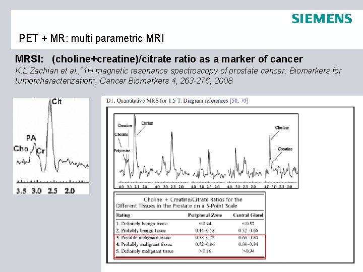 PET + MR: multi parametric MRI MRSI: (choline+creatine)/citrate ratio as a marker of cancer