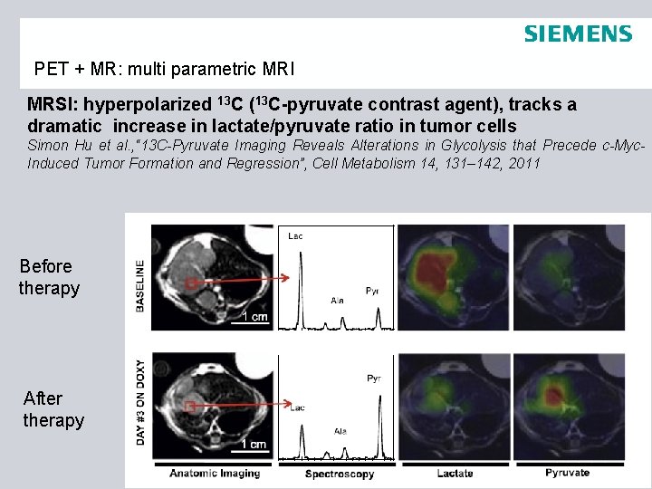 PET + MR: multi parametric MRI MRSI: hyperpolarized 13 C (13 C-pyruvate contrast agent),