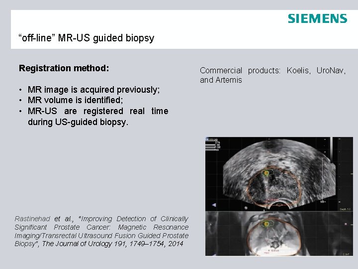 “off-line” MR-US guided biopsy Registration method: • MR image is acquired previously; • MR