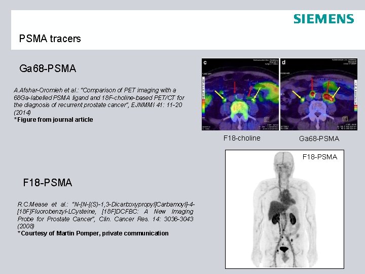 PSMA tracers Ga 68 -PSMA A. Afshar-Oromieh et al. : “Comparison of PET imaging