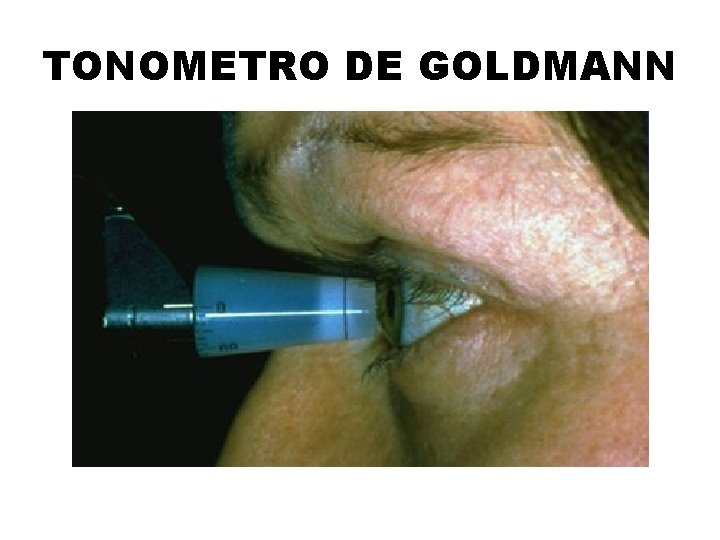 TONOMETRO DE GOLDMANN 