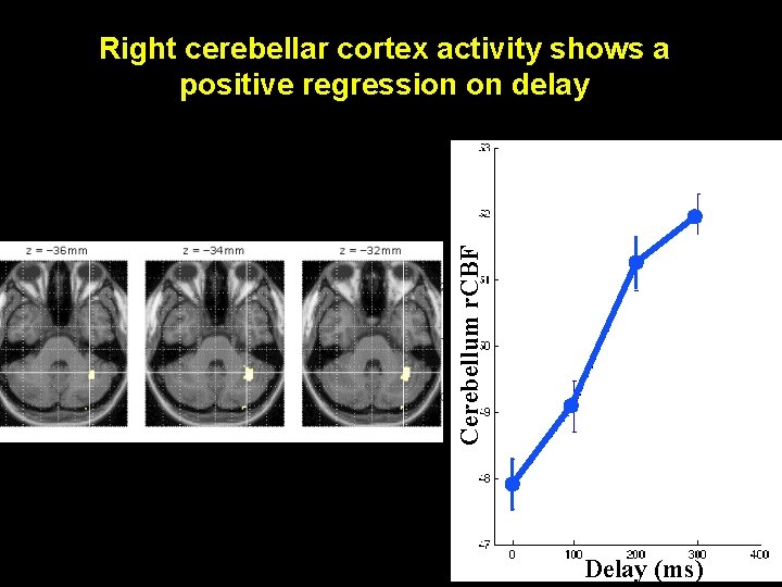 Cerebellum r. CBF Right cerebellar cortex activity shows a positive regression on delay Delay