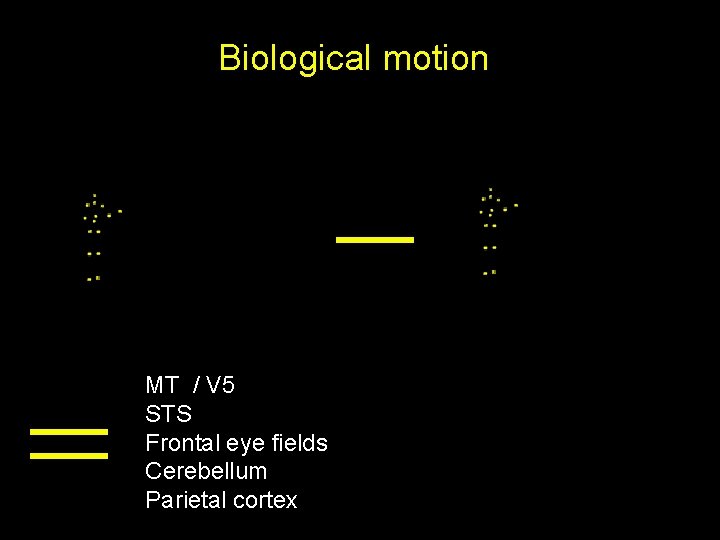 Biological motion MT / V 5 STS Frontal eye fields Cerebellum Parietal cortex 