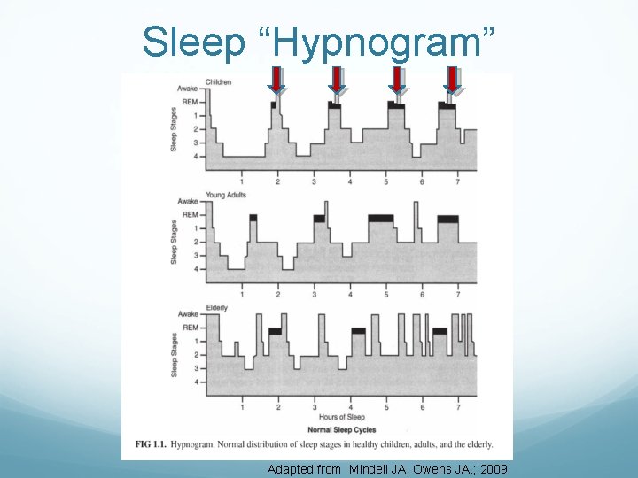 Sleep “Hypnogram” Adapted from Mindell JA, Owens JA. ; 2009. 