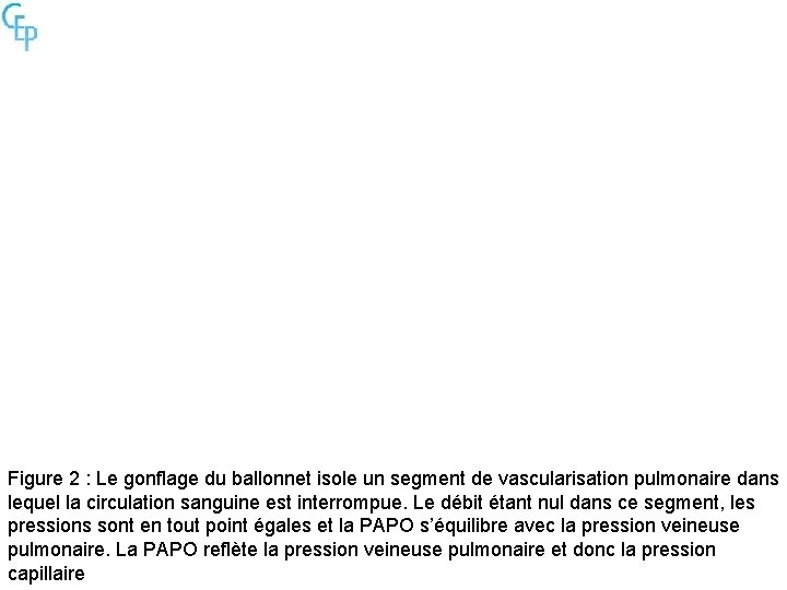 Figure 2 : Le gonflage du ballonnet isole un segment de vascularisation pulmonaire dans