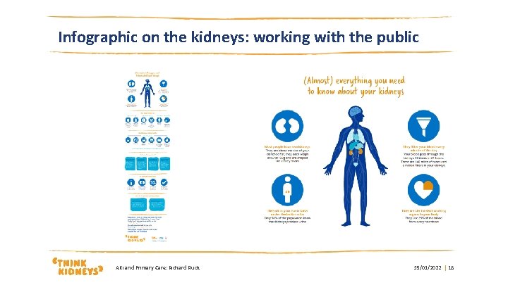 Infographic on the kidneys: working with the public AKi and Primary Care: Richard Fluck