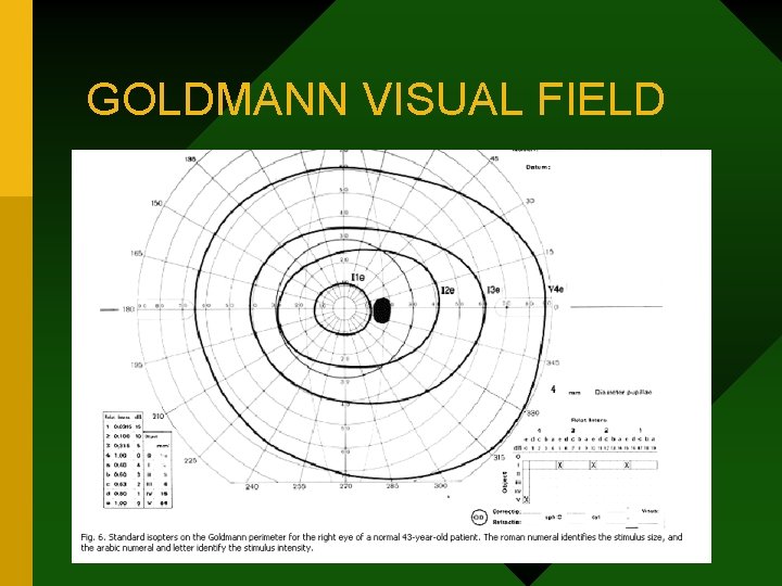 GOLDMANN VISUAL FIELD 