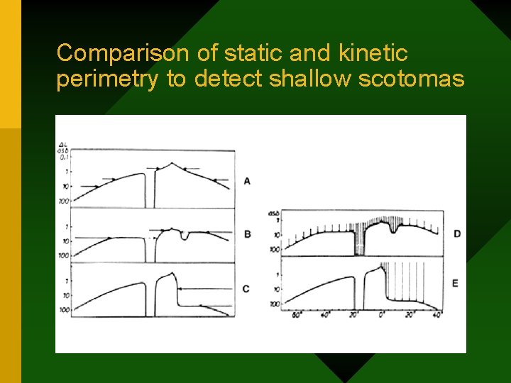 Comparison of static and kinetic perimetry to detect shallow scotomas 