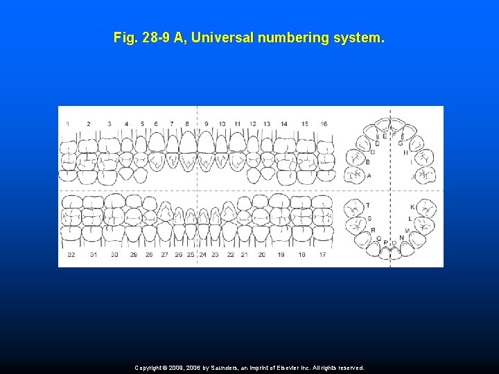 Fig. 28 -9 A, Universal numbering system. Copyright © 2009, 2006 by Saunders, an