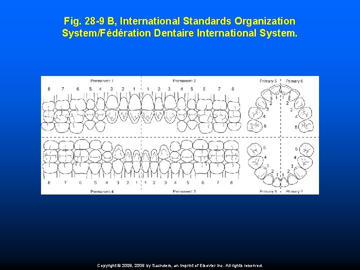 Fig. 28 -9 B, International Standards Organization System/Fédération Dentaire International System. Copyright © 2009,