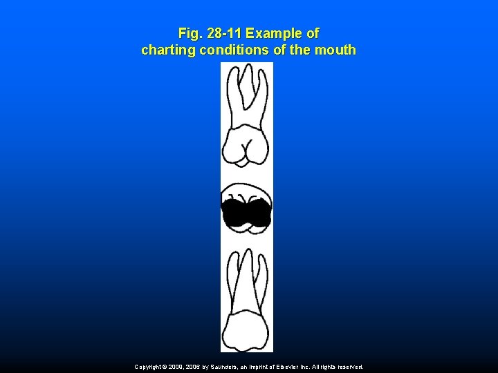 Fig. 28 -11 Example of charting conditions of the mouth Copyright © 2009, 2006