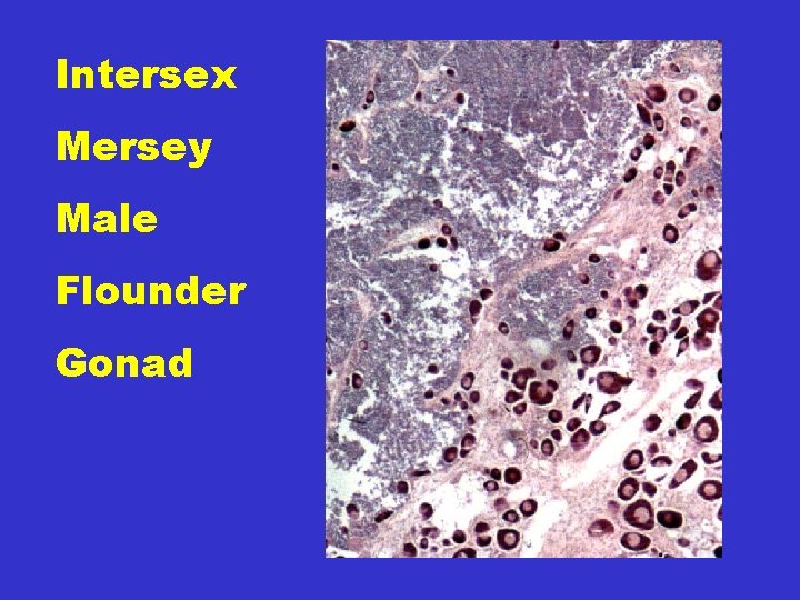 Intersex Mersey Male Flounder Gonad Intersex Flounder 
