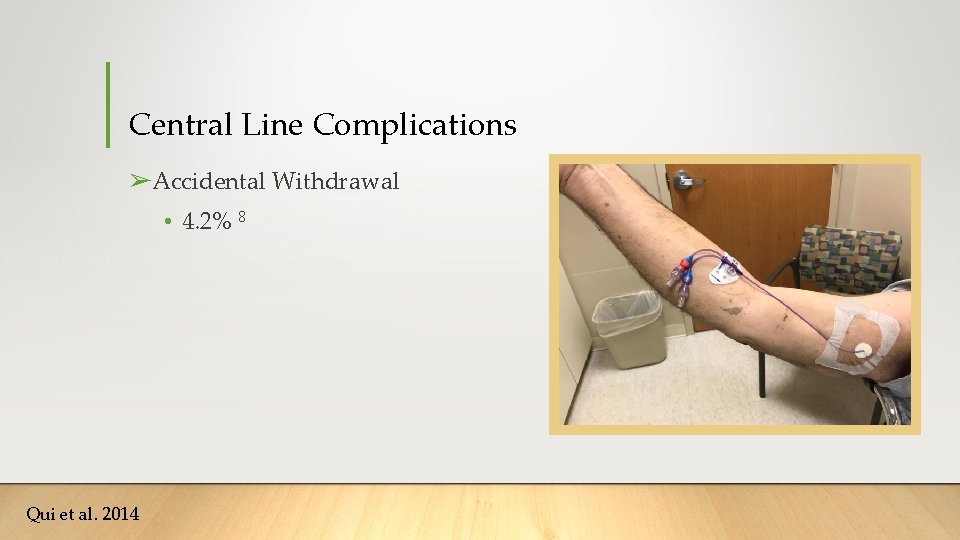 Central Line Complications ➢Accidental Withdrawal • 4. 2% 8 Qui et al. 2014 Central Line Complications ➢Accidental Withdrawal • 4. 2% 8 Qui et al. 2014