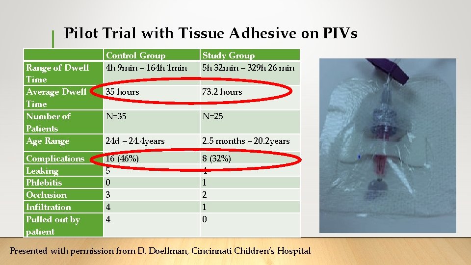Pilot Trial with Tissue Adhesive on PIVs Range of Dwell Time Average Dwell Time Pilot Trial with Tissue Adhesive on PIVs Range of Dwell Time Average Dwell Time