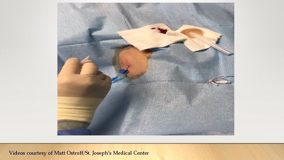 Videos courtesy of Matt Ostroff/St. Joseph’s Medical Center Videos courtesy of Matt Ostroff/St. Joseph’s Medical Center