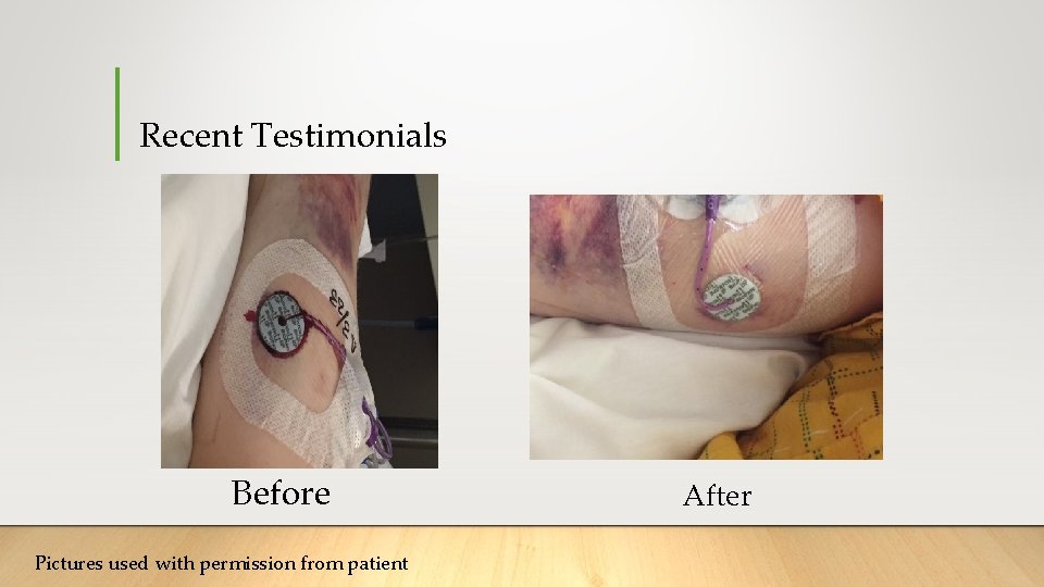 Recent Testimonials Before Pictures used with permission from patient After Recent Testimonials Before Pictures used with permission from patient After