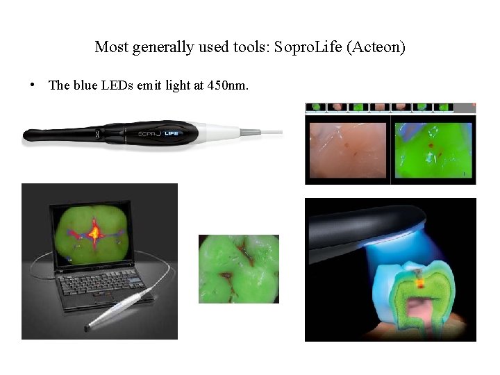 Most generally used tools: Sopro. Life (Acteon) • The blue LEDs emit light at