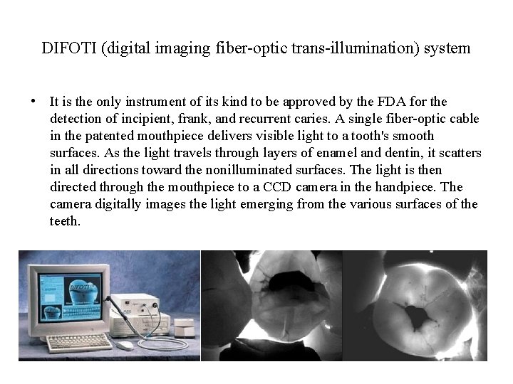 DIFOTI (digital imaging fiber-optic trans-illumination) system • It is the only instrument of its