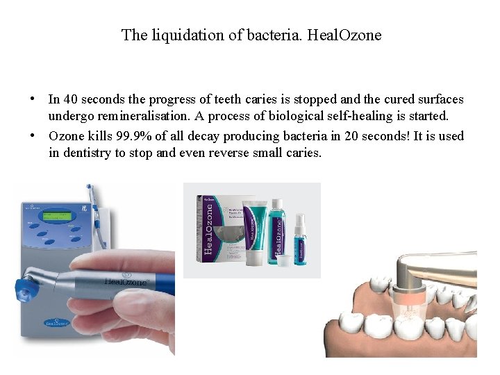 The liquidation of bacteria. Heal. Ozone • In 40 seconds the progress of teeth