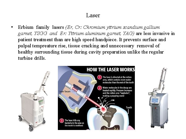 Laser • Erbium family lasers (Er, Cr: Chromium yttrium scandium gallium garnet, YSGG and