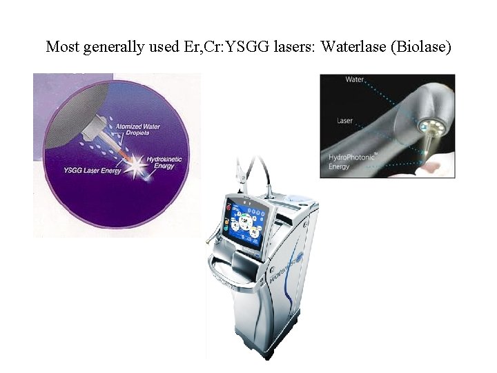 Most generally used Er, Cr: YSGG lasers: Waterlase (Biolase) 