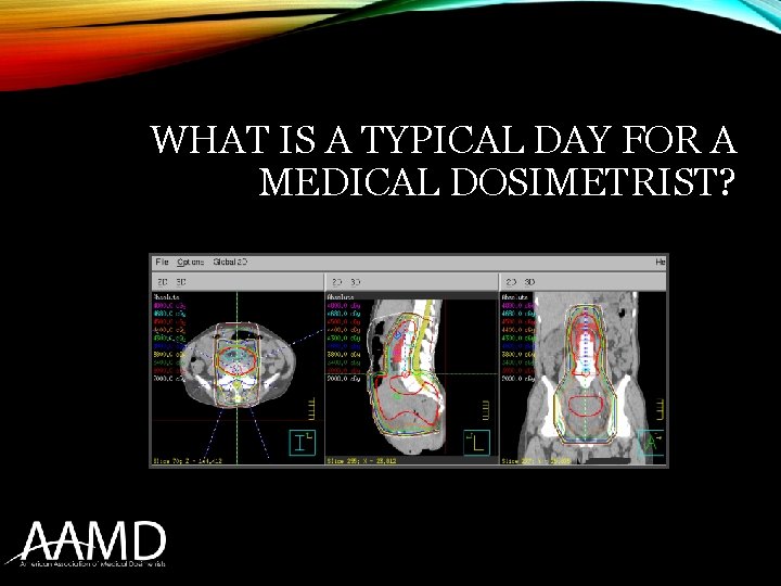 WHAT IS A TYPICAL DAY FOR A MEDICAL DOSIMETRIST? 