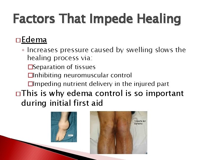 Factors That Impede Healing � Edema ◦ Increases pressure caused by swelling slows the