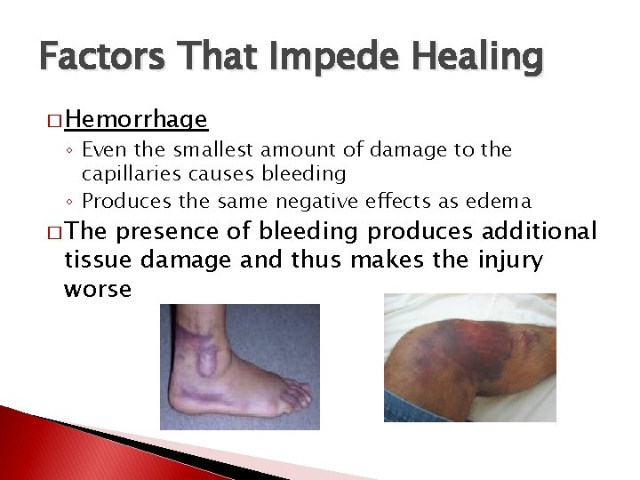 Factors That Impede Healing � Hemorrhage ◦ Even the smallest amount of damage to