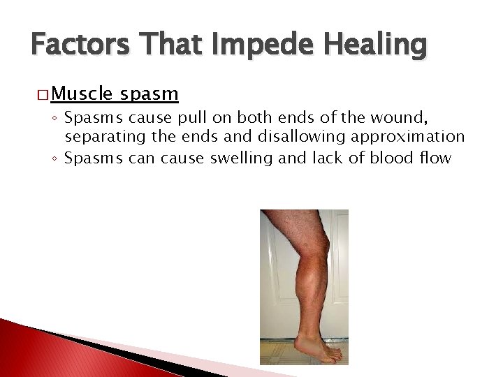 Factors That Impede Healing � Muscle spasm ◦ Spasms cause pull on both ends
